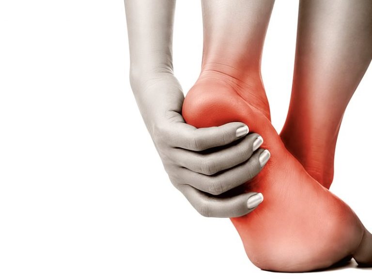 DOLOR DE TALON: ¿TENGO UN ESPOLON?