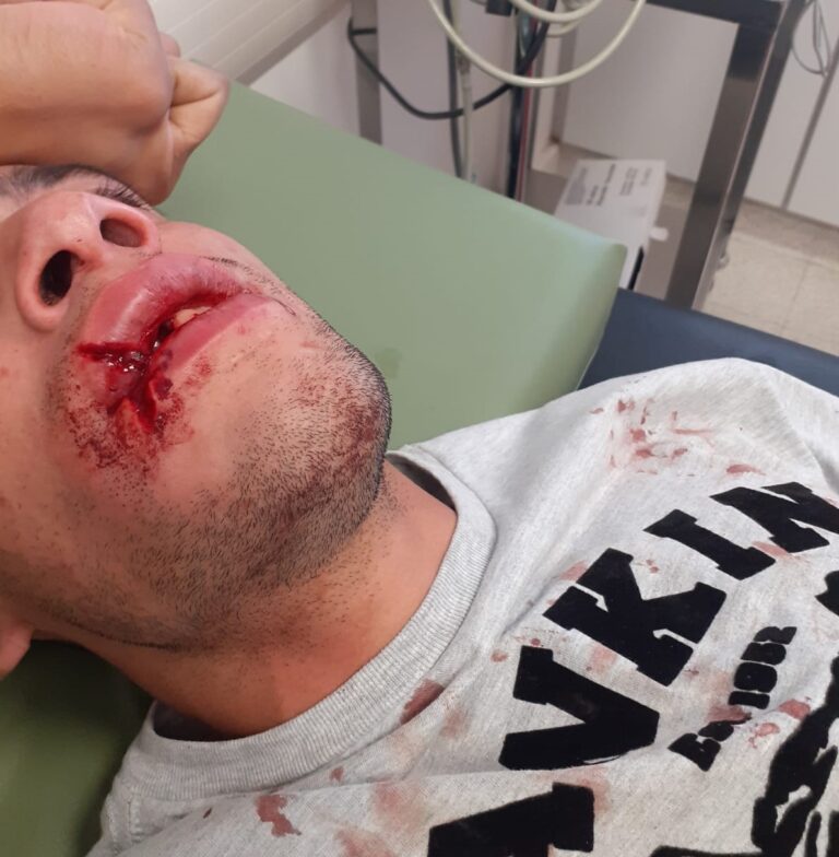 Las Grutas: otro joven severamente lesionado en la zona de la tercera bajada
